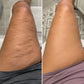 15-Day Fast Acting Anti-Cellulite Gold Gel
