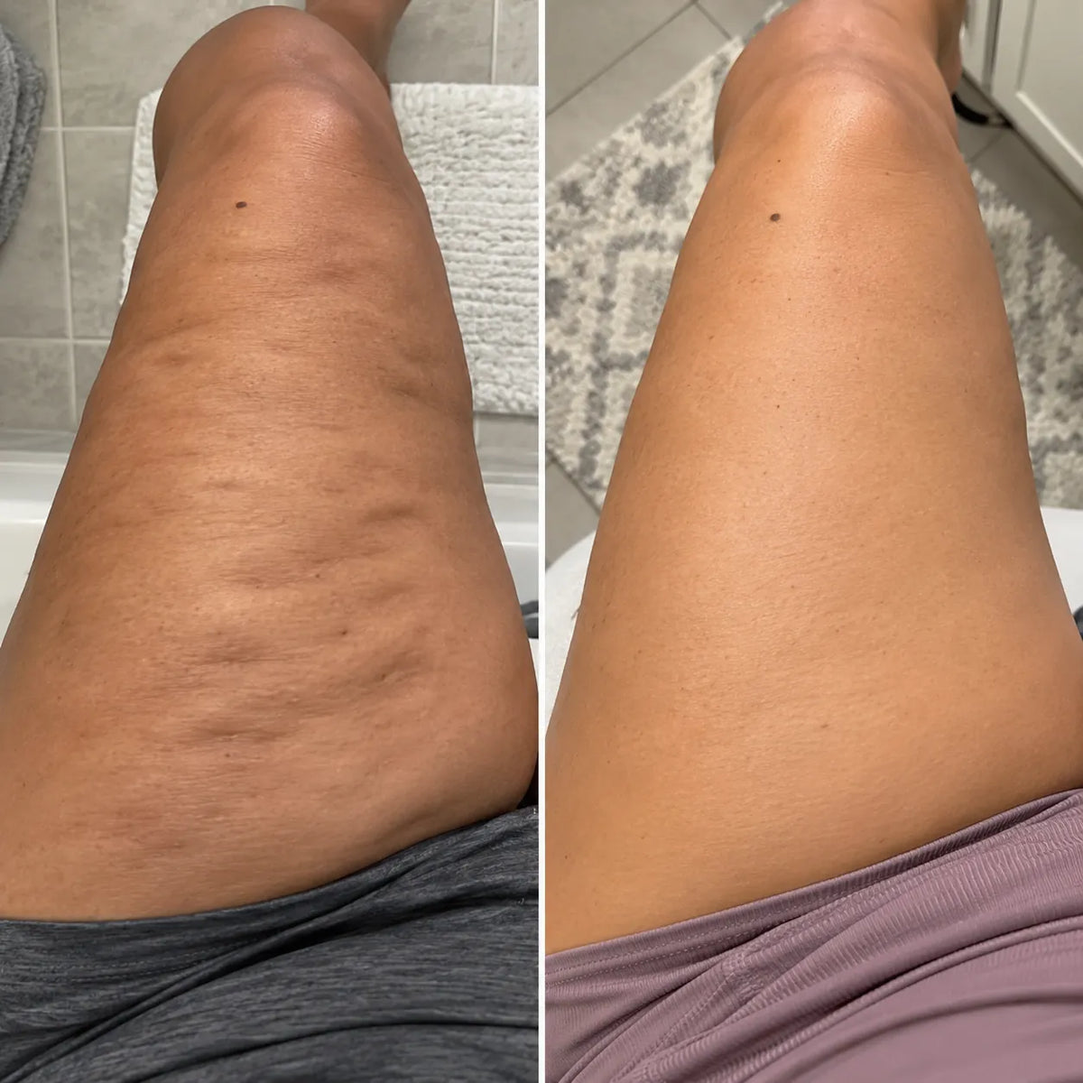 15-Day Fast Acting Anti-Cellulite Gold Gel